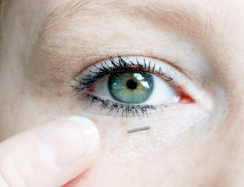 Image: The Nanoform Glucose Measurement Biosensor (Photo courtesy of Fraunhofer IMS).